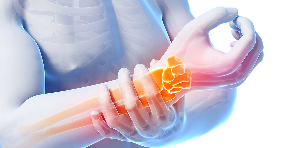 Prescott natural carpal tunnel treatment